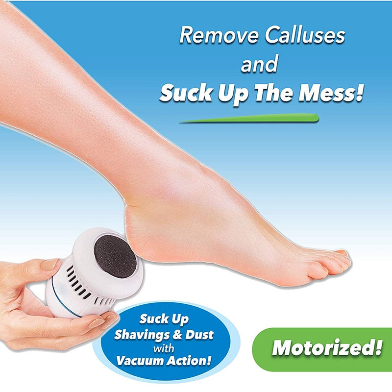 ELECTRIC DEAD SKIN REMOVER